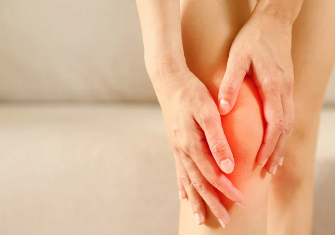 A lady holding her knee - which is red showing inflammation